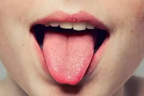 Color, Tongue