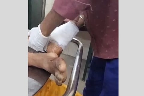 dog bite