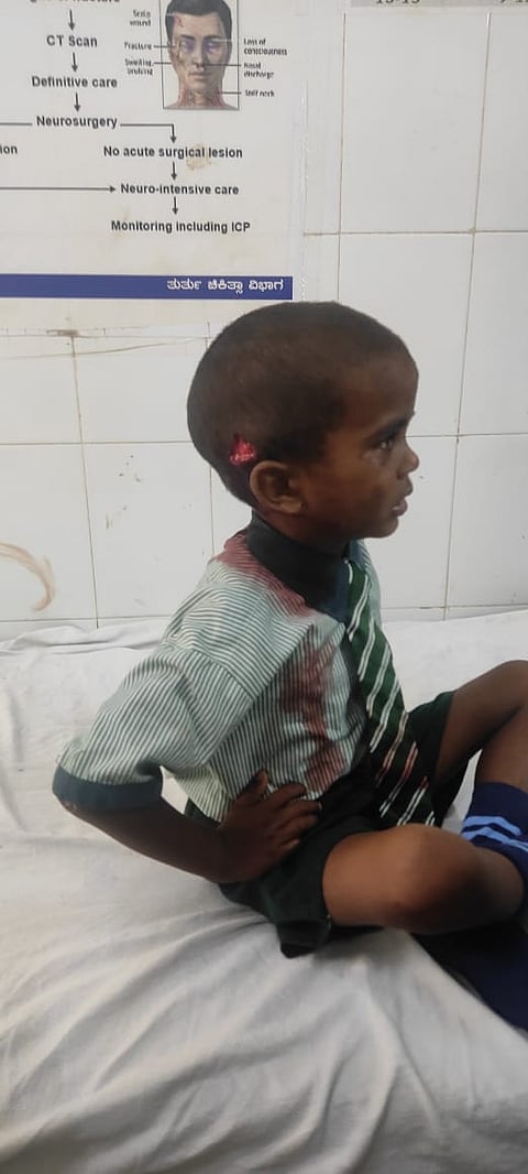 koppal dog bite children cmc hospital