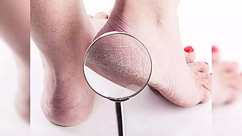 foot 3