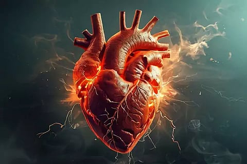 Heart Attack