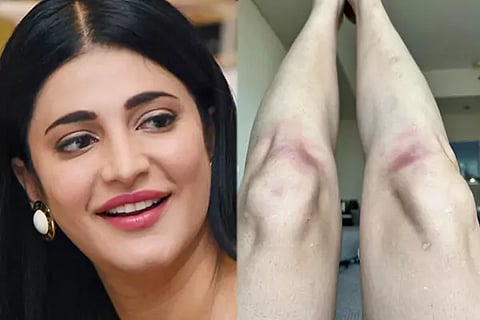 Shruti Haasan