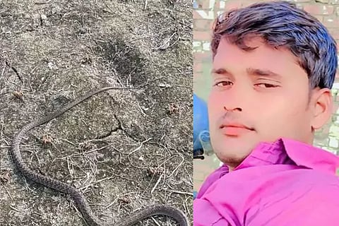 Snake Bite