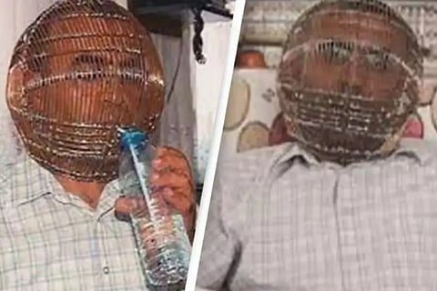 Turkish man locks his head in cage to quit smoking