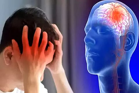 Brain Stroke