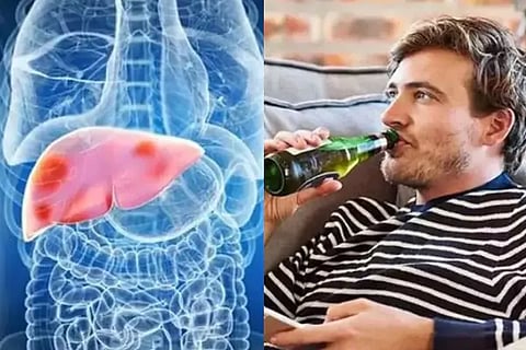 Liver Health