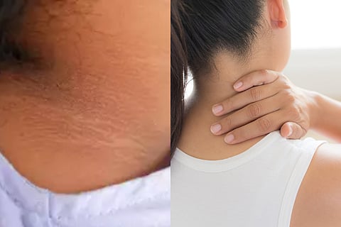 darkneck