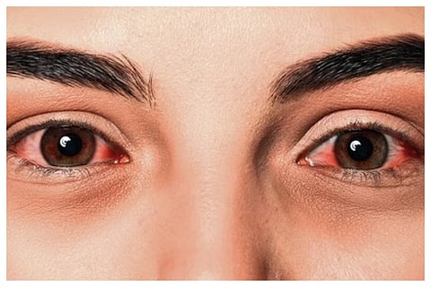 eye final