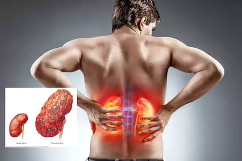 Kidney Health