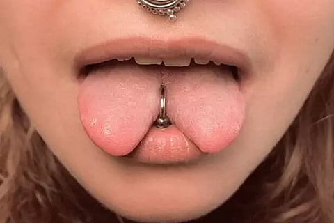 Tongue Splitting