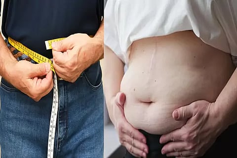 Weight loss
