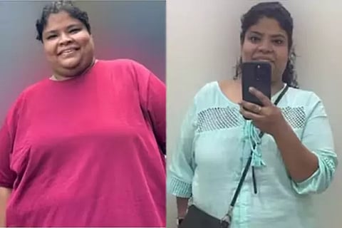 Weight Loss