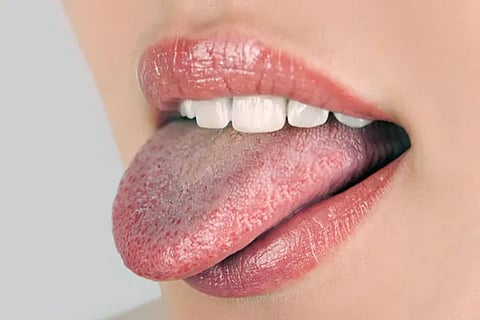 Tongue Mouth