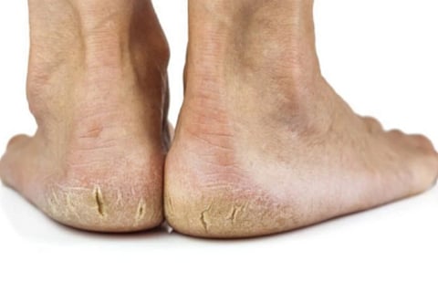feet