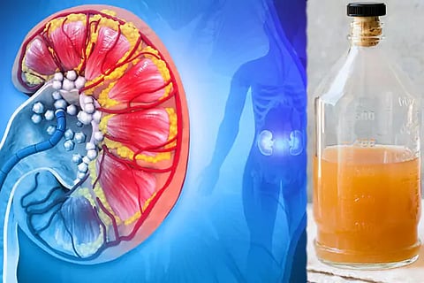 Kidney Health