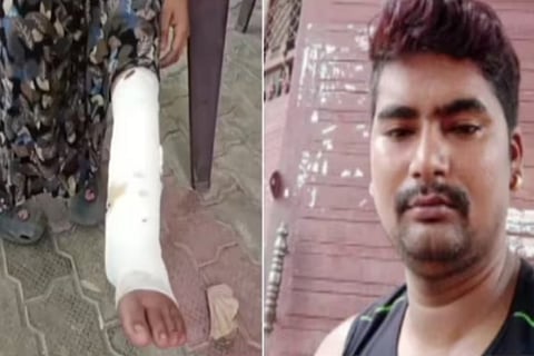 Kanpur cop hires snake charmers to kill wife she survives snakebite