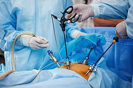 LAPRO Scopic