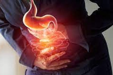 gastric