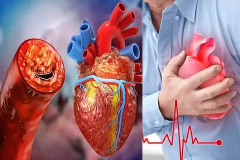 Heart Blockage