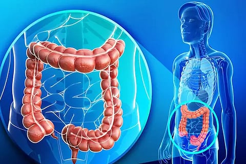 Intestinal Health
