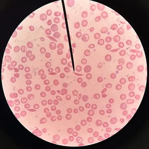sicale cell