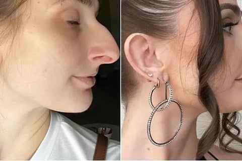 viral