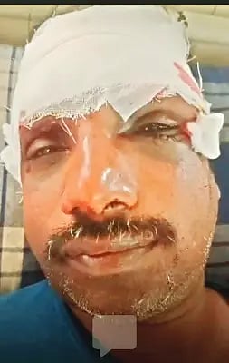 VINAY karadi attack