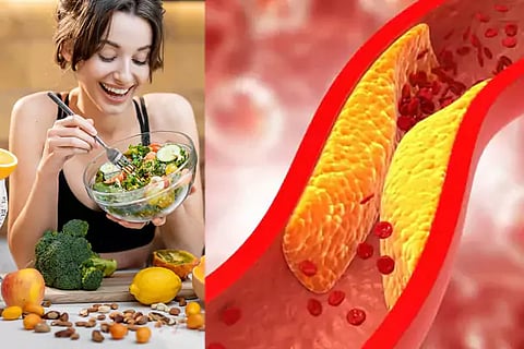Cholesterol