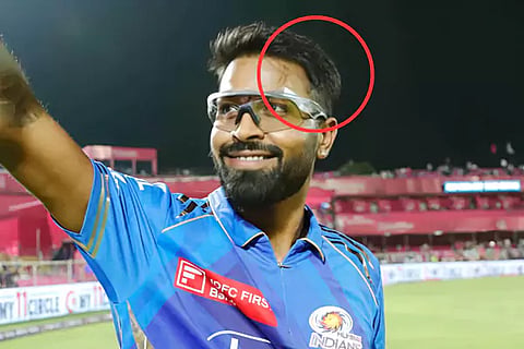 Hardik Pandya