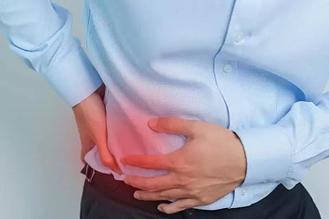Kidney Stones