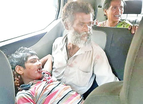 ಮಾವಿನ ಮರದಿಂದ ಬಿದ್ದು, ಪೆಟ್ಟು