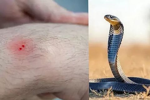 Snake