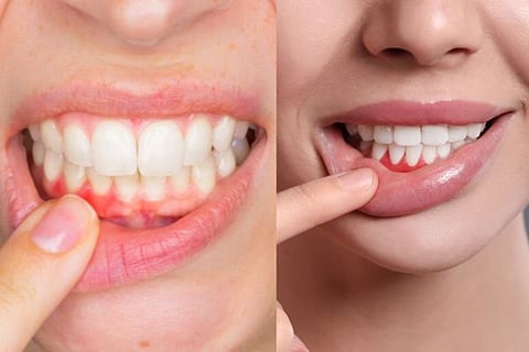 teeth