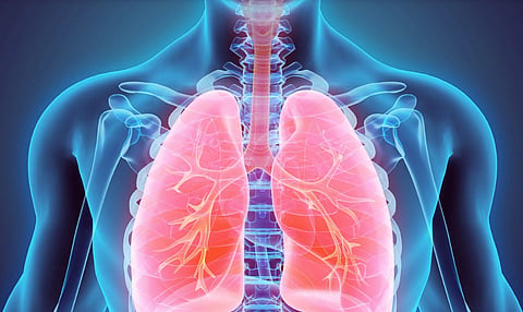 Lung Cancer
