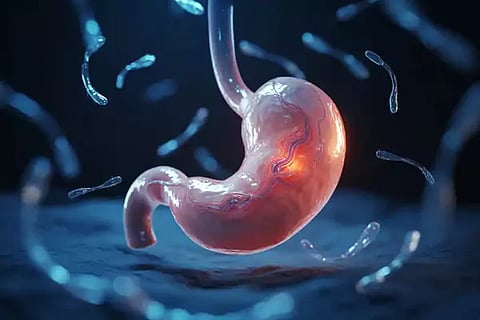 Gastric Problems