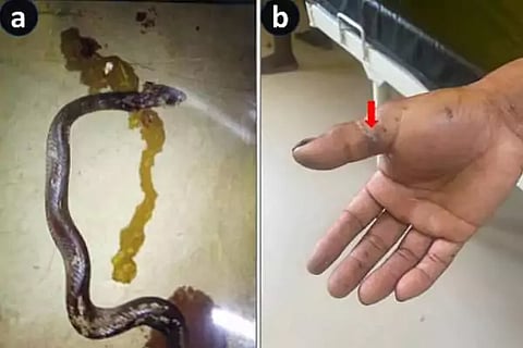 Snakes