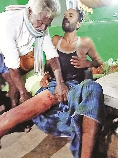 ಗುಂಡ್ಲುಪೇಟೆ ತಾಲೂಕಿನ ಕುಂದಕೆರೆ ಗ್ರಾಮದಲ್ಲಿ ಕಾಡೆಮ್ಮೆ ದಾಳಿಯಿಂದ ಗಾಯಗೊಂಡಿರುವ ರೈತ ಪಾಲಾಕ್ಷ.