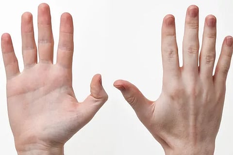 Hands
