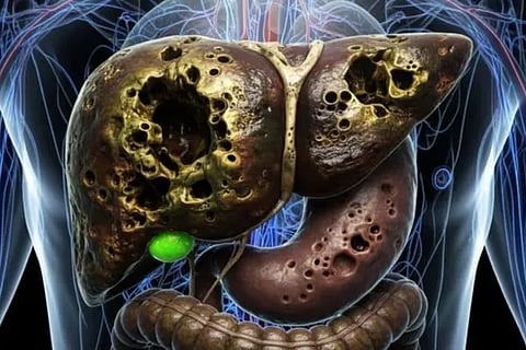 Liver Health