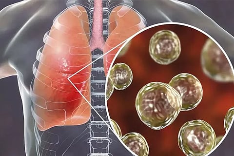 Lung Infection
