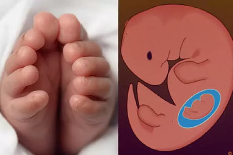 Newborn Baby
