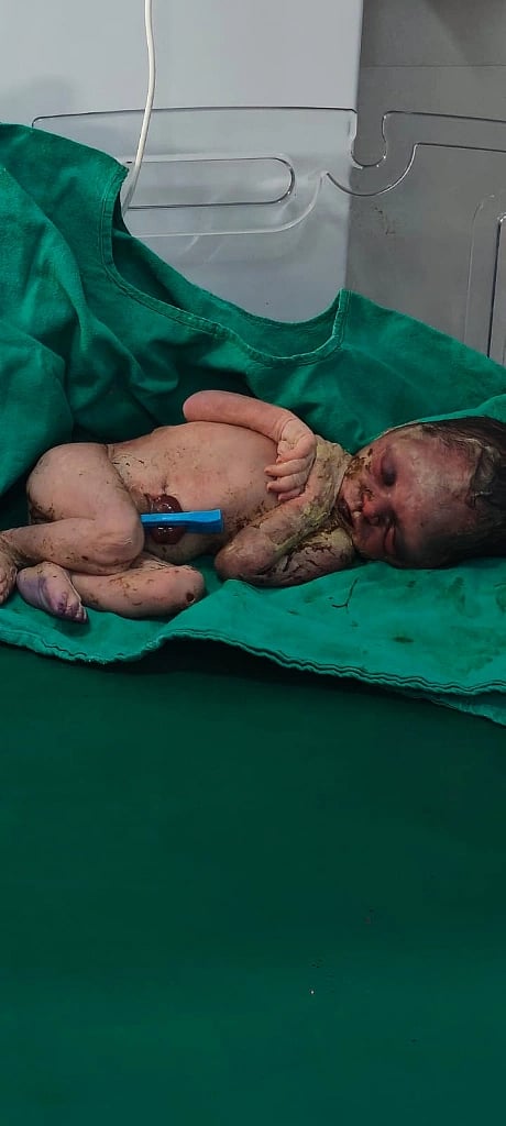 New Born Baby Death