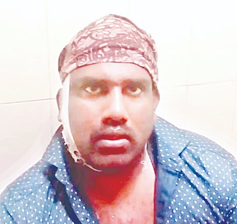 ಕೊಳ್ಳೇಗಾಲ ತಾಲೂಕಿನ ಮುಳ್ಳೂರು ಗ್ರಾಮದ ನಿವಾಸಿ ಗಾಯಾಳು ಮಹೇಶ್ ಪಟ್ಟಣದ ಸರ್ಕಾರಿ ಆಸ್ಪತ್ರೆಯಲ್ಲಿ ಚಿಕಿತ್ಸೆ ಪಡೆಯುತ್ತಿರುವುದು.