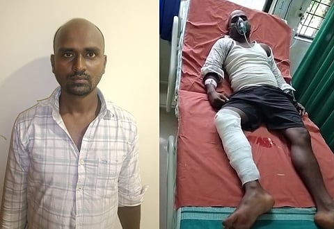 ಪೊಲೀಸರ ಗುಂಡೇಟಿನಿಂದ ಗಾಯಗೊಂಡು ಉಡುಪಿ ಜಿಲ್ಲಾಸ್ಪತ್ರೆಯಲ್ಲಿ ಚಿಕಿತ್ಸೆಗೆ ದಾಖಲಾಗಿರುವ ಆರೋಪಿ ಅನುಜ್​ ಪಾಟೀಲ್​.