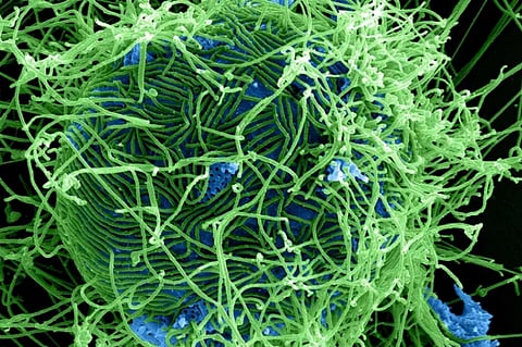 Ebola virus 