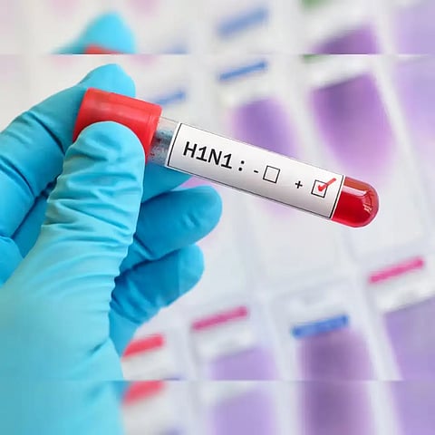 H1N1 Virus 