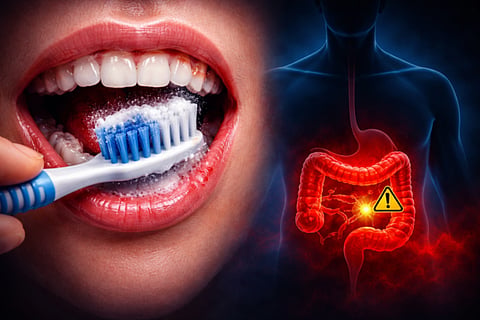 ColonCancer 