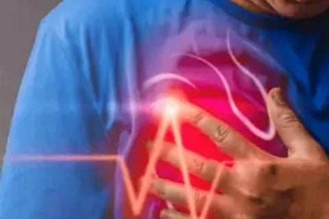 Heart Attack