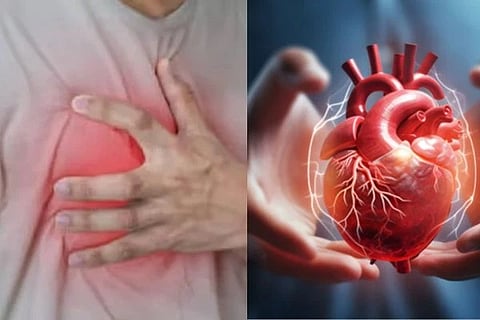 Heart attack | ಹೃದಯಾಘಾತದ ಚಿತ್ರ