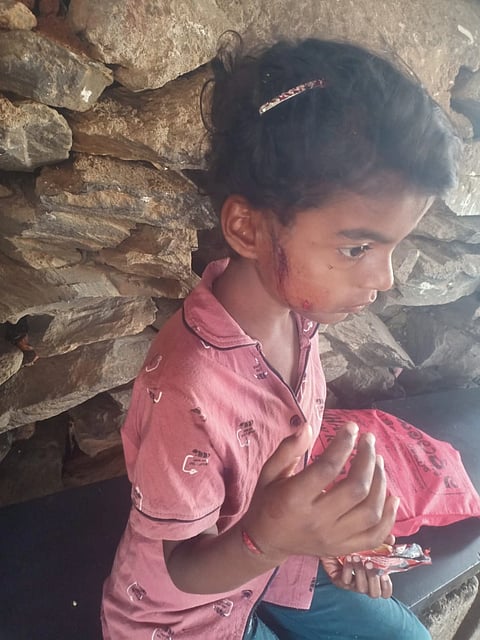 ಗಾಯಗೊಂಡ ಬಾಲಕಿ